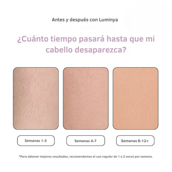 Depiladora Luminya IPL I La depilación láser líder para tu hogar
