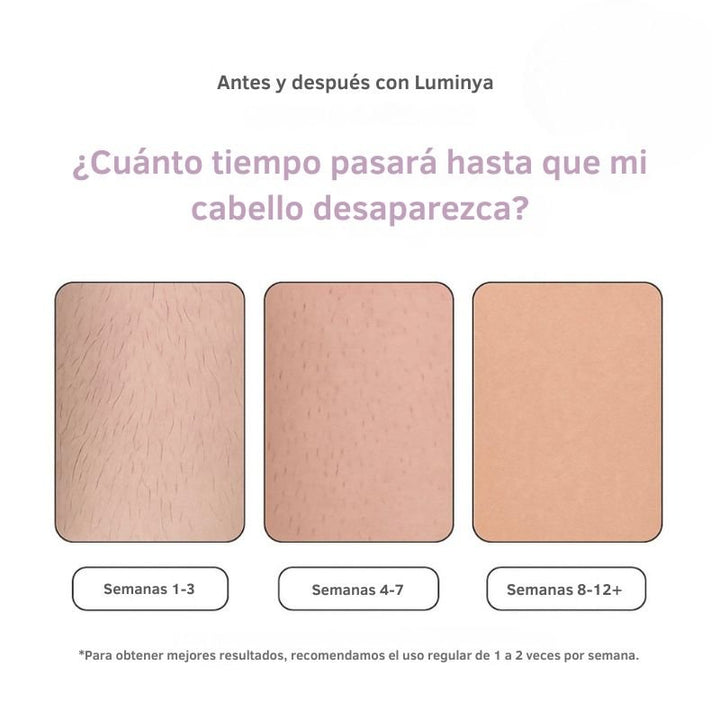 Depiladora Luminlic IPL - Depilar Laser Líder Ahora en tu Hogar - Big Happy