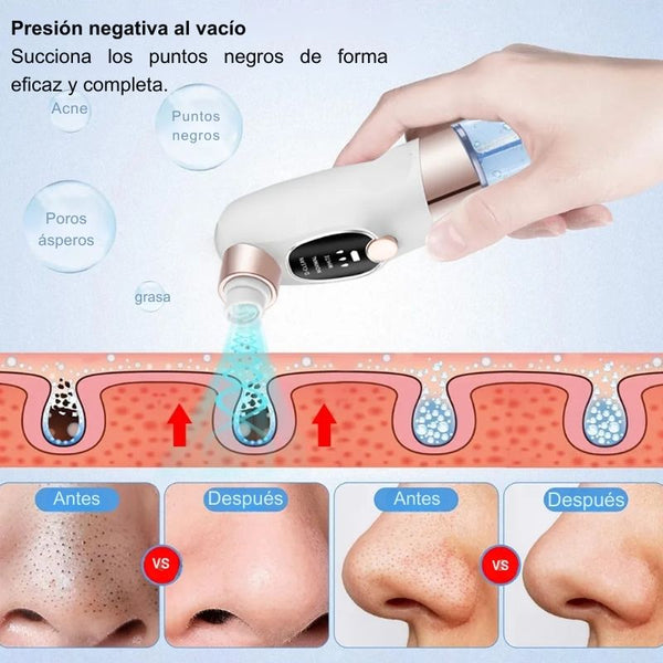 Hidrolimpiador Facial para Impurezas BigSuc