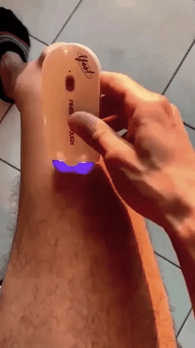 Novedosa Depiladora Porttatil Electrica YEST Unisex🙋‍♂️🙋‍♀️ - Big Happy