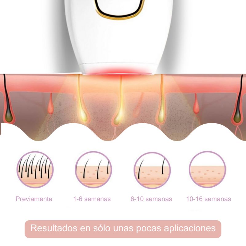 Depiladora Luminlic IPL - La depilación láser líder para tu hogar