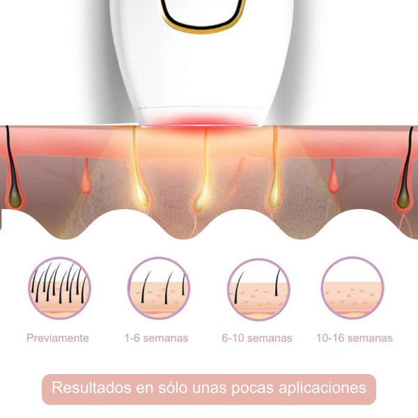 Depiladora Luminlic IPL - La depilación láser líder para tu hogar